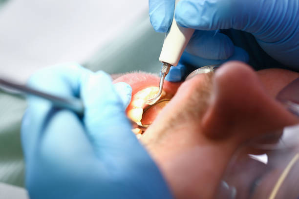 Best Same-Day Emergency Dentist in Farm Loop, AK